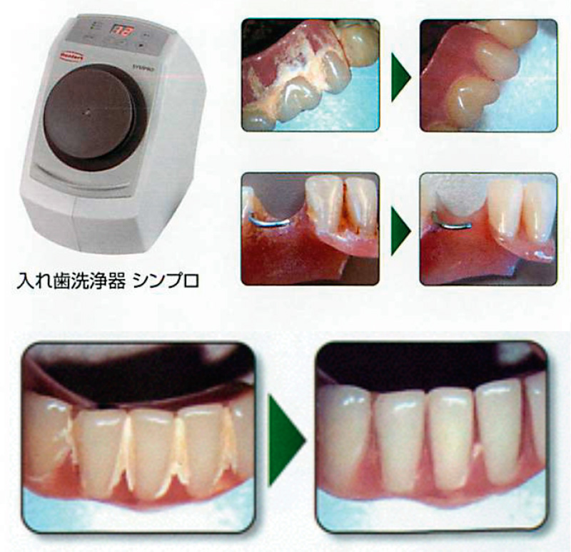 入れ歯の汚れはもちろん臭いも激減❗歯科医院で推奨されている超音波